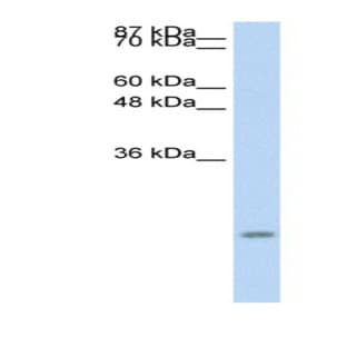 anti-Chemokine (C-C Motif) Ligand 13 (CCL13) (Middle Region) antibody avatar
