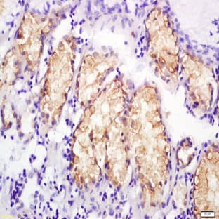 anti-Chemokine (C-C Motif) Ligand 13 (CCL13) antibody avatar