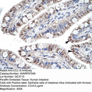 anti-Chemokine (C-C Motif) Ligand 18 (Pulmonary and Activation-Regulated) (CCL18) (Middle Region) antibody avatar