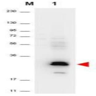anti-Chemokine (C-C Motif) Ligand 20 (CCL20) antibody avatar
