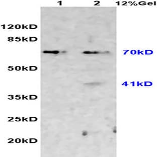 anti-Chemokine (C-X3-C Motif) Ligand 1 (CX3CL1) antibody avatar