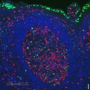 anti-PR Domain Containing 1, with ZNF Domain (PRDM1) (AA 199-409) antibody avatar