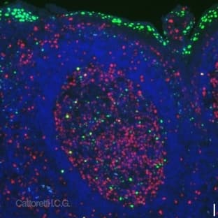 anti-PR Domain Containing 1, with ZNF Domain (PRDM1) (AA 199-409) antibody avatar