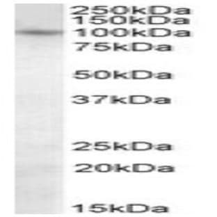 anti-PR Domain Containing 1, with ZNF Domain (PRDM1) (C-Term) antibody avatar
