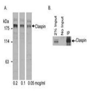 anti-Claspin (CLSPN) (AA 725-775) antibody avatar