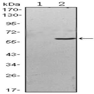 anti-B Lymphoid Tyrosine Kinase (BLK) antibody avatar