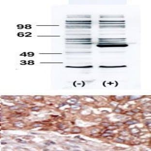 anti-B Lymphoid Tyrosine Kinase (BLK) (N-Term) antibody avatar