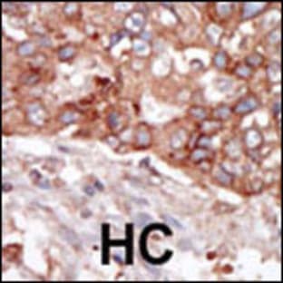 anti-B Lymphoid Tyrosine Kinase (BLK) (N-Term), (AA 1-30) antibody avatar