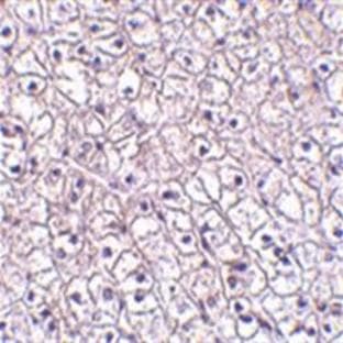 anti-Cytokine Receptor-Like Factor 2 (CRLF2) (Middle Region) antibody avatar