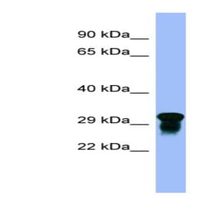anti-Chromosome 10 Open Reading Frame 54 (C10orf54) (N-Term) antibody avatar