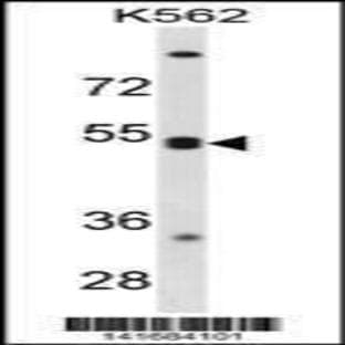 anti-Chemokine (C-X-C Motif) Receptor 5 (CXCR5) (N-Term), (AA 1-30) antibody avatar