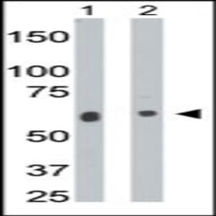 anti-Ceramide Kinase (CERK) (C-Term), (AA 487-516) antibody avatar