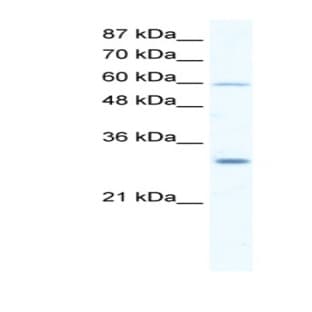 anti-DEAD (Asp-Glu-Ala-Asp) Box Polypeptide 31 (DDX31) (N-Term) antibody avatar