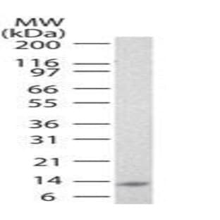 anti-Interleukin 25 (IL25) antibody