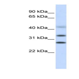 anti-Centromere Protein H (CENPH) (Middle Region) antibody avatar