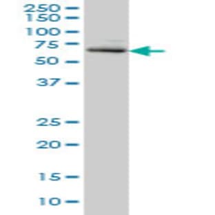 anti-Adrenocortical Dysplasia Homolog (Mouse) (ACD) (AA 1-545) antibody avatar
