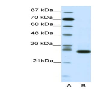 anti-Cyclin-Dependent Kinase 5 (CDK5) (N-Term) antibody avatar