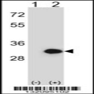 anti-2,3-bisphosphoglycerate Mutase (BPGM) (C-Term), (AA 230-259) antibody avatar