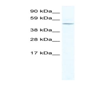 anti-Ceramide Synthase 4 (CERS4) (N-Term) antibody avatar