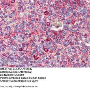 anti-B-Cell CLL/lymphoma 11A (Zinc Finger Protein) (BCL11A) (N-Term) antibody avatar