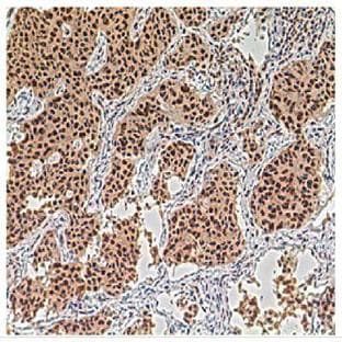 anti-Aurora Kinase A (AURKA) antibody avatar