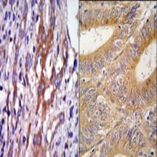 anti-Aurora Kinase A (AURKA) (N-Term) antibody avatar