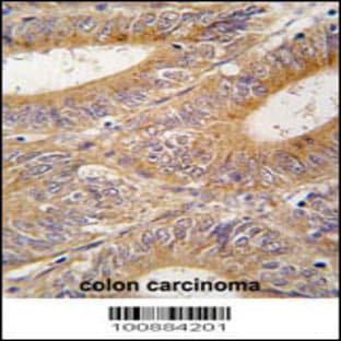 anti-Aurora Kinase A (AURKA) (N-Term), (AA 90-120) antibody avatar