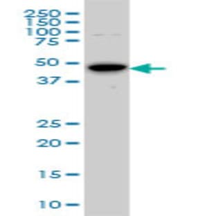 anti-Aurora Kinase A (AURKA) (AA 1-111) antibody avatar