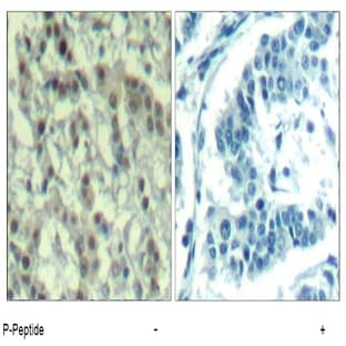anti-Aurora Kinase A (AURKA) (pThr288) antibody avatar