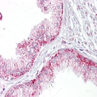 anti-Aurora Kinase A (AURKA) (C-Term) antibody avatar