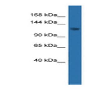 anti-Cyclin-Dependent Kinase-Like 5 (CDKL5) (C-Term) antibody avatar