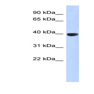 anti-Aurora Kinase C (AURKC) (Middle Region) antibody avatar