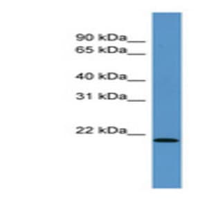 anti-Actin Related Protein 2/3 Complex, Subunit 4, 20kDa (ARPC4) (N-Term) antibody avatar