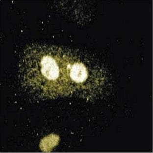 anti-Cyclin-Dependent Kinase 5, Regulatory Subunit 1 (p35) (CDK5R1) (AA 1-94) antibody avatar