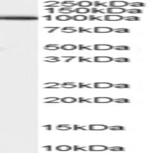 anti-ADAM Metallopeptidase Domain 17 (ADAM17) (C-Term) antibody avatar