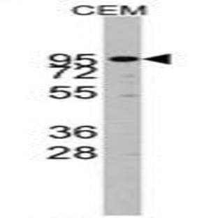 anti-ADAM Metallopeptidase Domain 17 (ADAM17) (N-Term) antibody avatar