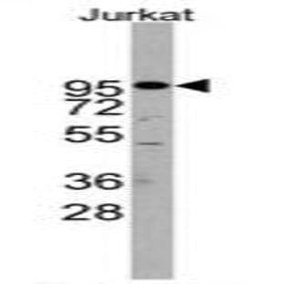 anti-ADAM Metallopeptidase Domain 17 (ADAM17) (C-Term) antibody avatar