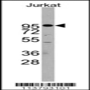 anti-ADAM Metallopeptidase Domain 17 (ADAM17) (C-Term), (AA 794-823) antibody avatar
