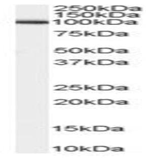 anti-ADAM Metallopeptidase Domain 17 (ADAM17) (C-Term) antibody avatar