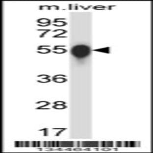 anti-Casein Kinase 1, gamma 3 (CSNK1G3) (C-Term), (AA 333-361) antibody avatar