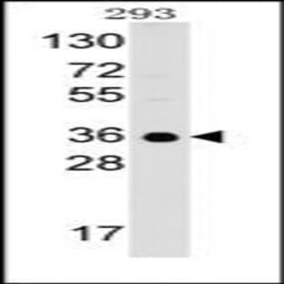 anti-Complement Component 1, Q Subcomponent Binding Protein (C1QBP) (C-Term) antibody avatar