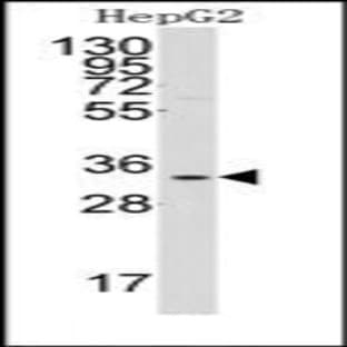 anti-Complement Component 1, Q Subcomponent Binding Protein (C1QBP) (Middle Region) antibody avatar