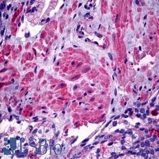 anti-Actin, gamma 1 (ACTG1) antibody avatar