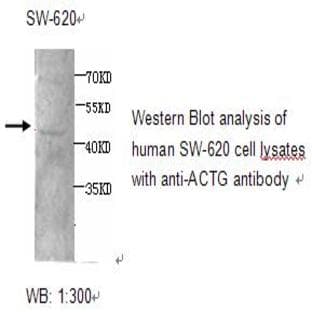 anti-Actin, gamma 1 (ACTG1) antibody avatar