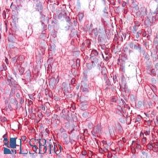 anti-Actin, gamma 1 (ACTG1) antibody avatar