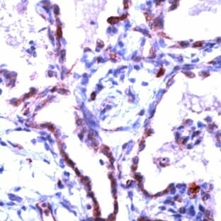 anti-Claudin 5 (CLDN5) (C-Term) antibody avatar