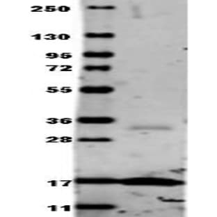 anti-Tumor Necrosis Factor (TNF) antibody