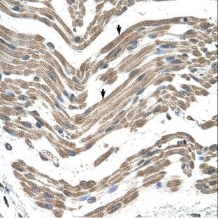 anti-Complement Component 1, Q Subcomponent, B Chain (C1QB) (C-Term) antibody avatar