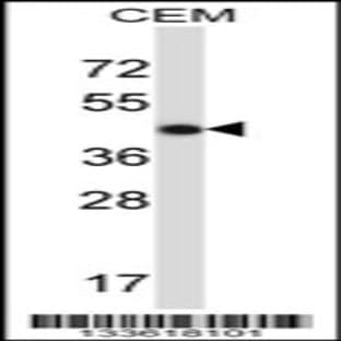 anti-Actin, gamma 2, Smooth Muscle, Enteric (ACTG2) (C-Term), (AA 343-371) antibody avatar