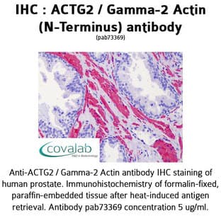 anti-Actin, gamma 2, Smooth Muscle, Enteric (ACTG2) (N-Term) antibody avatar